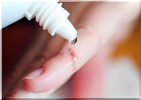 poor wound healing is one of the symptoms of a weak immune system