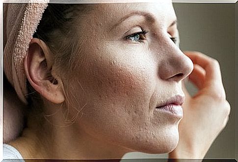 Skin discomfort as a sign of high cortisol levels