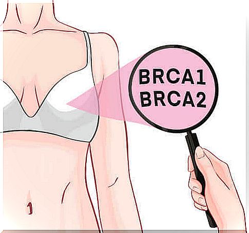 Breast cancer and the role of the BRCA-1 and BRCA-2 genes