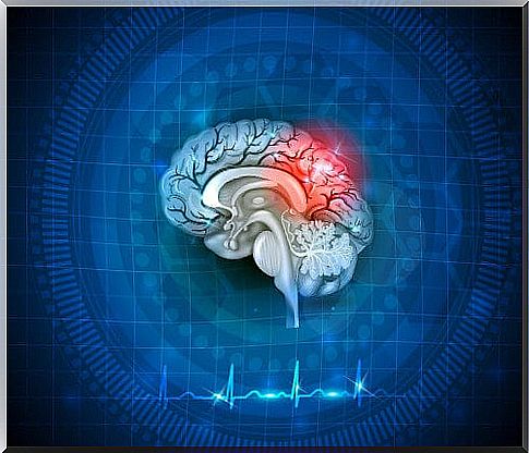 Causes of cerebral hypoxia