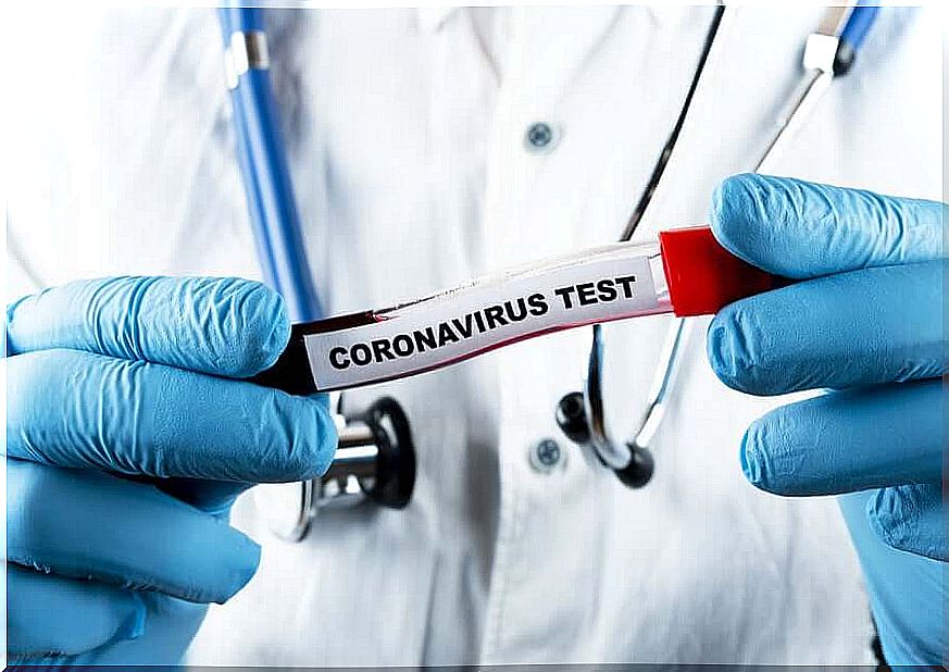 Corona pandemic: what tests are there?