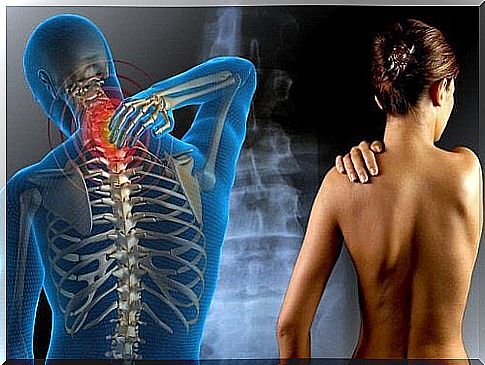 Fibromyalgia: muscle pain and fatigue