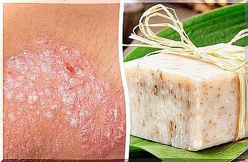 Homemade soap for treating eczema of the skin