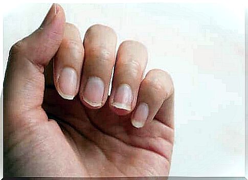 How to naturally strengthen your fingernails: 5 tips