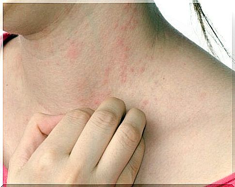 Skin problems from stress