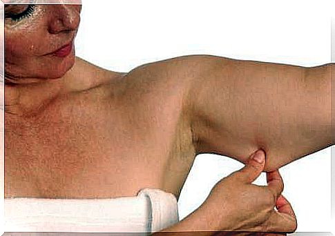 Sagging upper arms: what to do?