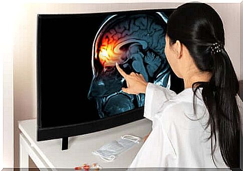 The meninges and their functions