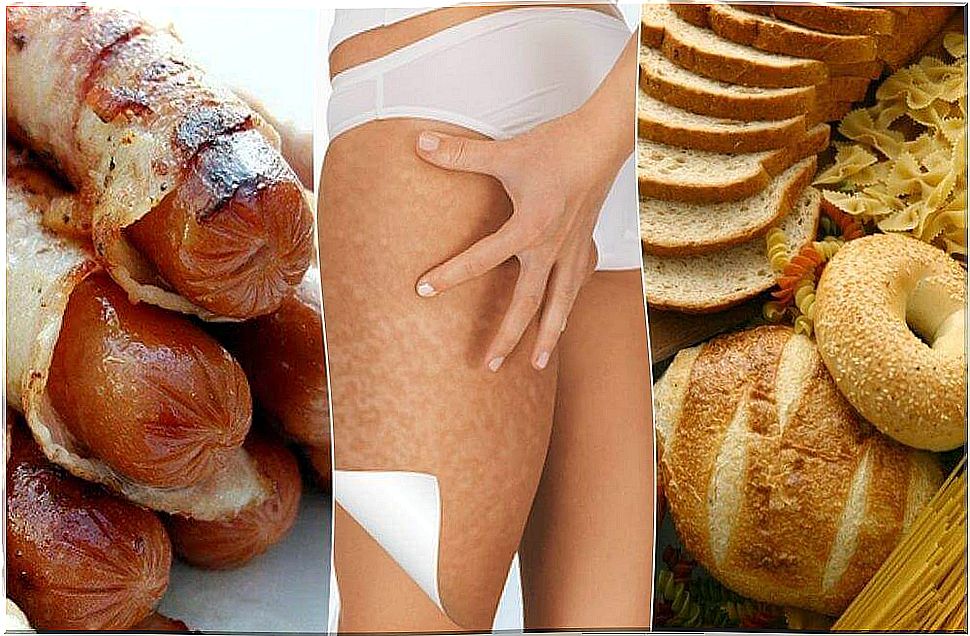 These foods promote cellulite