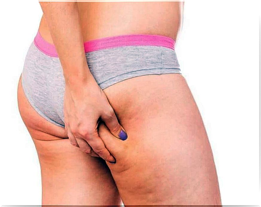 Worsen cellulite: thighs