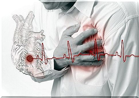 What is myocardial infarction?