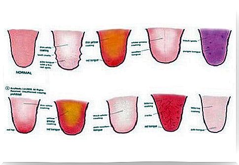 What the tongue can reveal about your soul and health