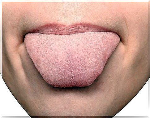 What white coating on the tongue reveals about soul and health