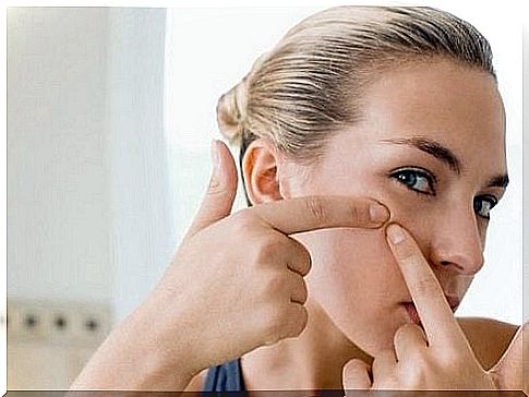 Woman uses baking soda against blackheads